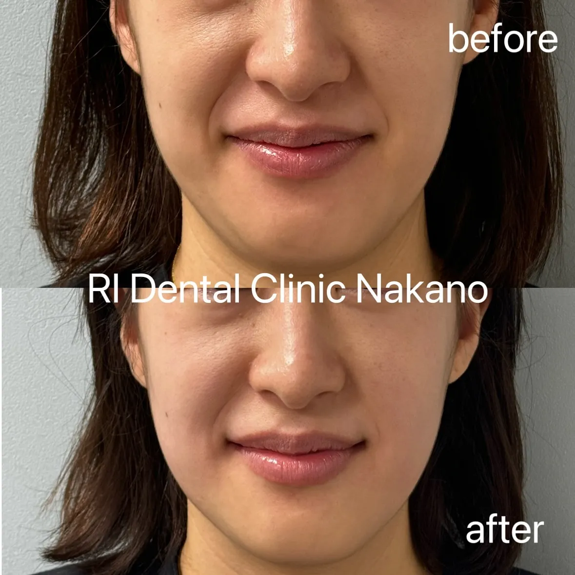 RI Dental Clinic Nakanoです。