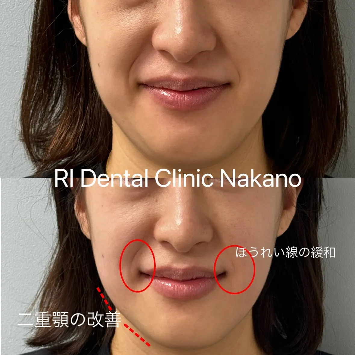 RI Dental Clinic Nakanoです。