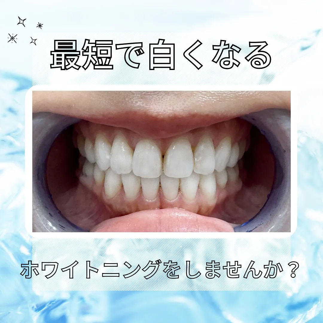 RIデンタルクリニック中野です🦷