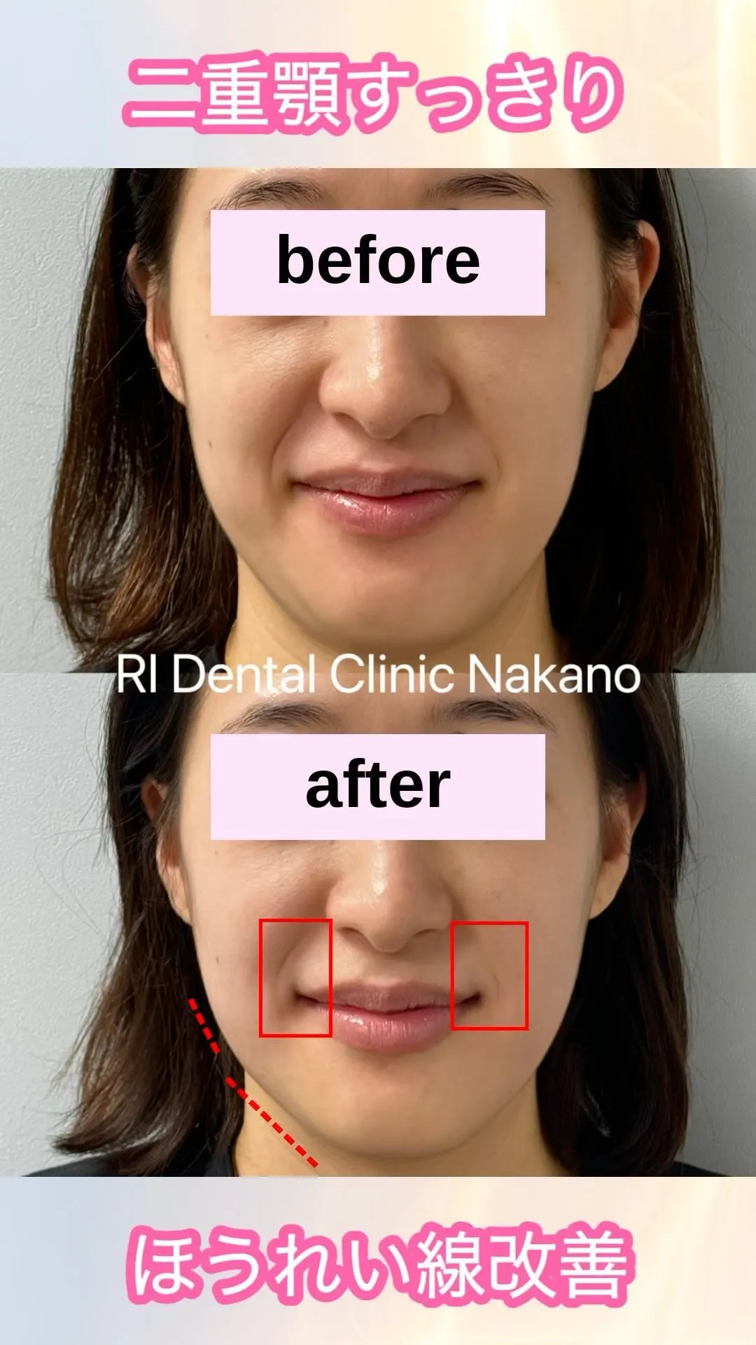 RI Dental Clinic Nakanoなら歯だけじゃ...